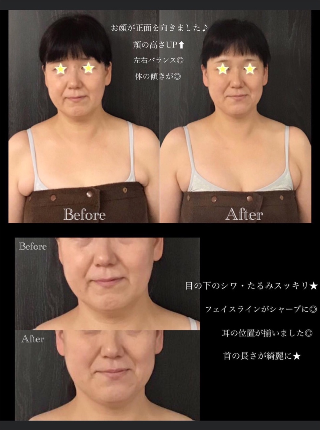はじめての人のための頭蓋骨矯正 | 医療情報研究所 DVD教材ストア