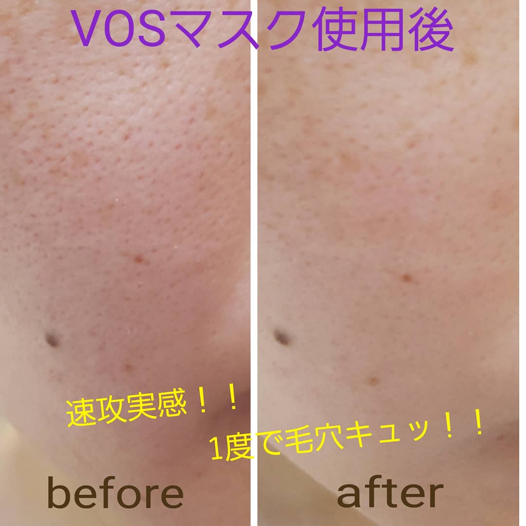 驚きの‼VOSマスク効果💫 - Soyeux ソワイユ東銀座店│東京都中央区銀座